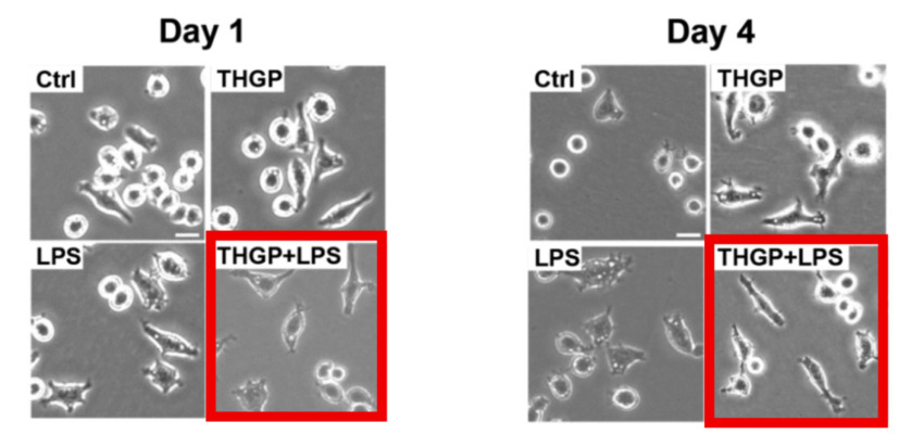 THGP(アサイゲルマニウム)とLPSの単独または併用で処理したRAW264.7細胞の形態変化